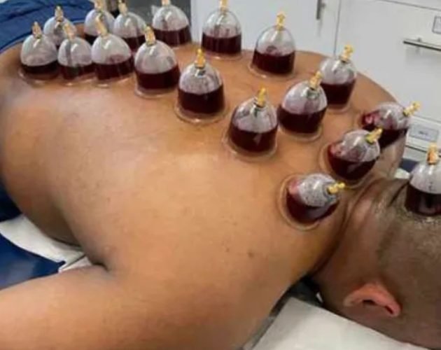 cr=t_0%,l_0%,w_100%,h_100% (43)